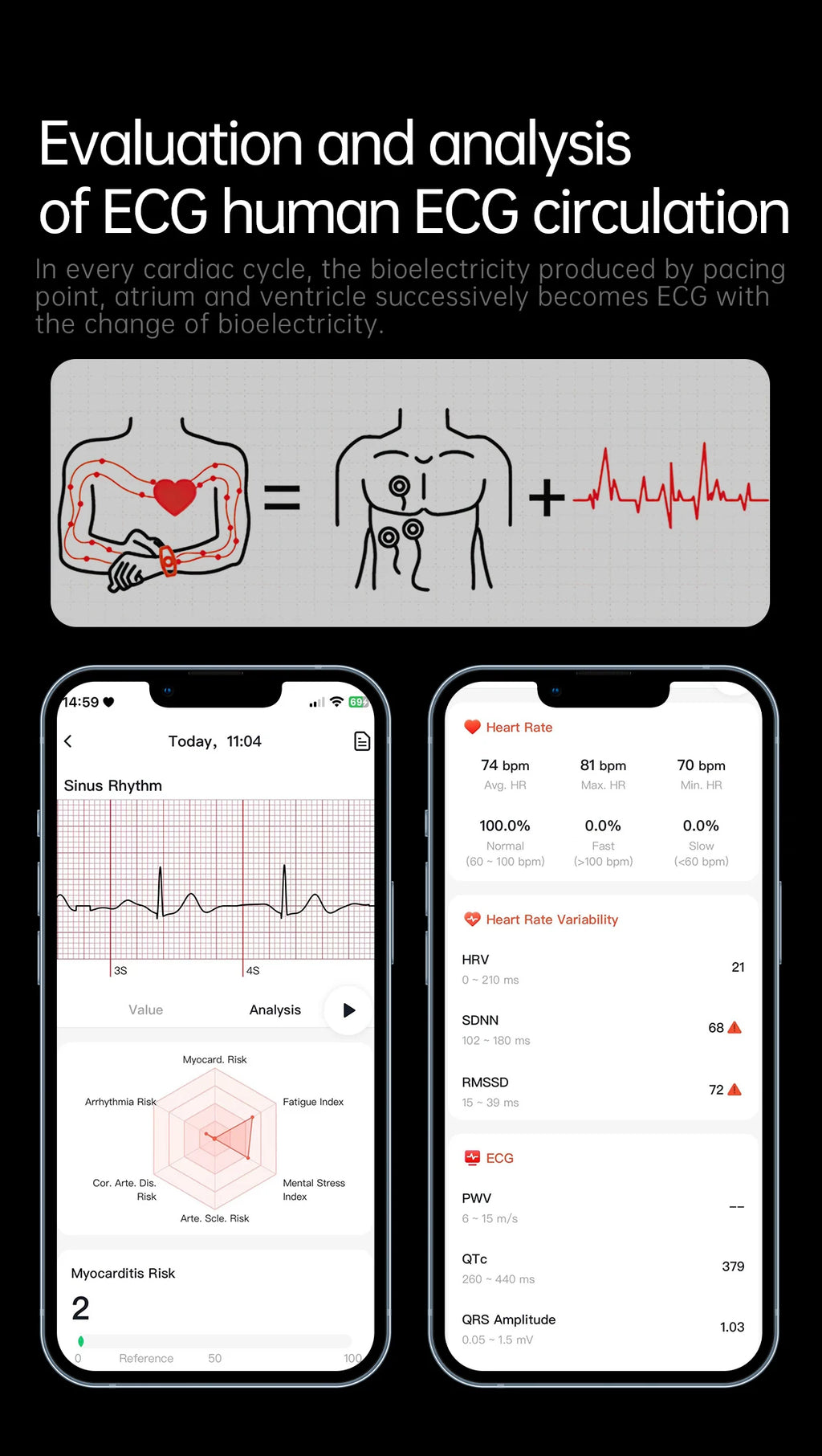 2025 New For HUAWEI ECG+PPG Three High Smart Watch Lipids Uric acid Blood pressure Smartwatch Men NFC Sport HD Call Health Clock