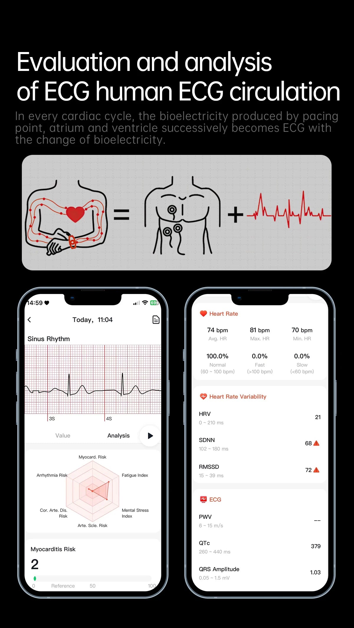 2025 New For HUAWEI ECG+PPG Three High Smart Watch Lipids Uric acid Blood pressure Smartwatch Men NFC Sport HD Call Health Clock