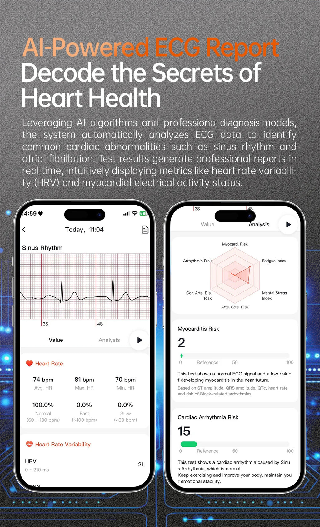 2025 New Health Analysis ECG+PPG Smart Watch Body Fat Uric Acid Blood Pressure Heart Rate Tracker NFC Smartwatch For Android IOS